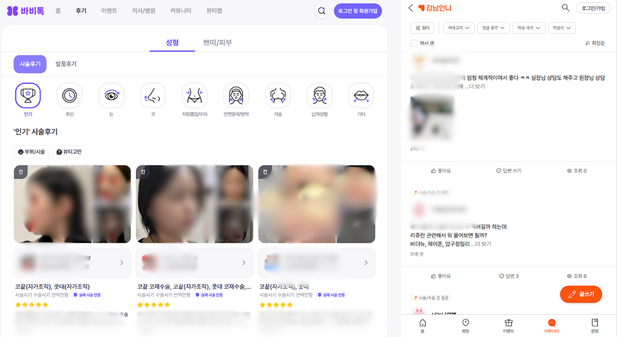 바비톡 강남언니 후기